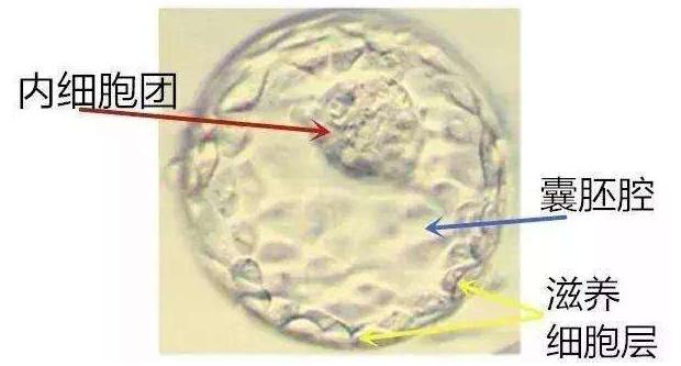 同时移植优质胚胎和非优质胚胎  对试管婴儿最终成功率的影响