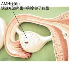 喜孕多小课堂：试管之前 以提高AMH值为目的的调理意义不大！