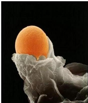试管婴儿过程中为什么有时会取到空卵或者是提前排卵