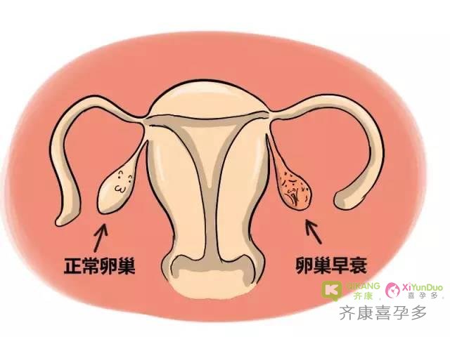 干细胞组织可以让卵巢早衰的女性恢复生育能力吗？