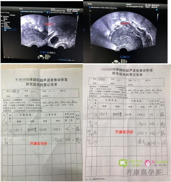 来自猪年的第一个好孕喜报，付出的努力总归是有回报的