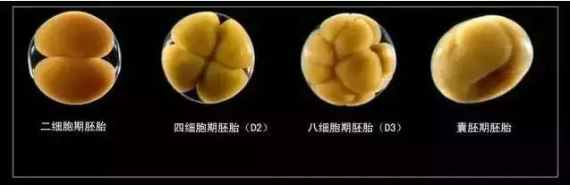 海外三代试管 为什么多建议单胎移植？囊胚移植有什么好处？