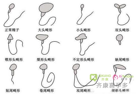 试管合格精液标准知多少：你的精子合格吗？