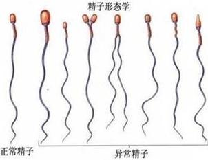 男性精子畸形率高的情况下，做试管婴儿的成功率有多高呢？