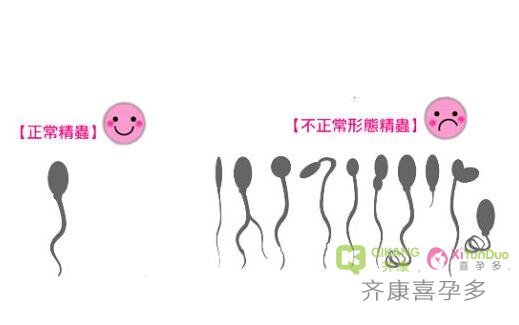 年龄这么重要？为什么女性年龄越大，试管的成功率就越低？