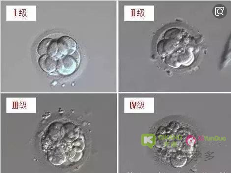 试管婴儿最后的成功要比“火箭少女”组合的选拔还要激烈残酷