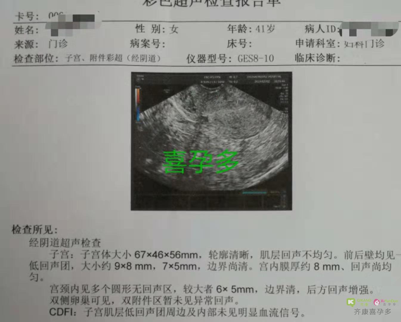 卵巢衰退 马来西亚供卵自怀双胞胎男宝成功——喜孕多金猪宝宝受孕实录记