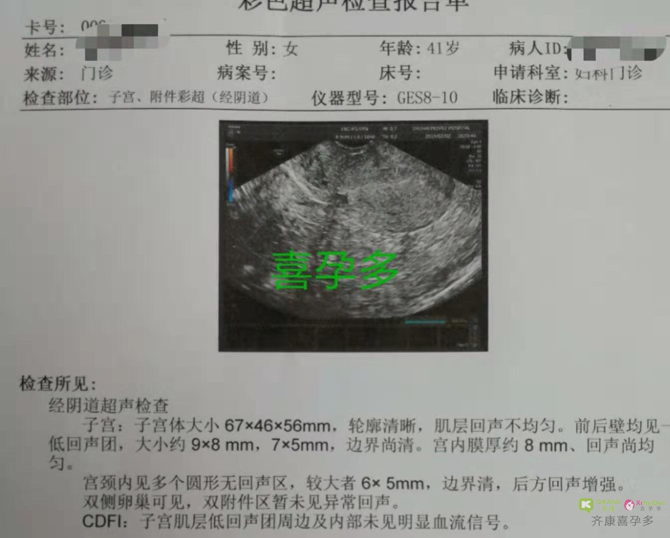 卵巢衰退 马来西亚供卵自怀双胞胎男宝成功——喜孕多金猪宝宝受孕实录记