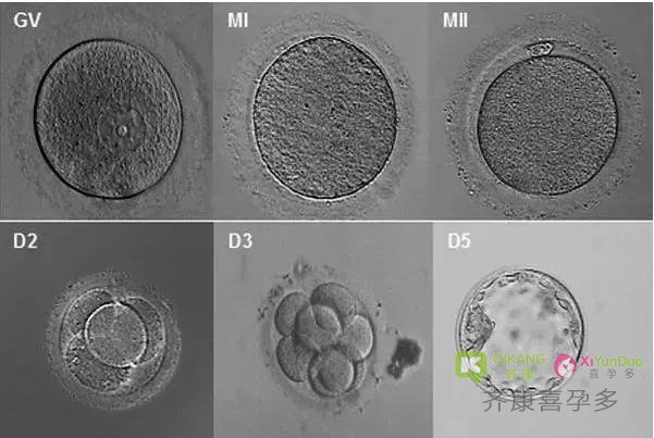 喜孕多海外试管小课堂——胚胎碎片是判断胚胎好坏的唯一标准吗？