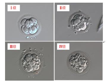 喜孕多海外试管小课堂——胚胎碎片是判断胚胎好坏的唯一标准吗？