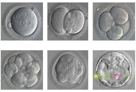 囊胚移植又什么优势？早期胚胎和囊胚的区别在哪里？