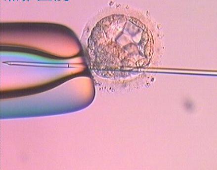 喜孕多海外试管：试管婴儿胚胎移植有哪几种方式移植？
