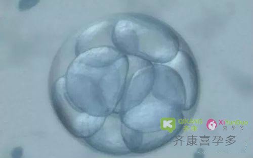 喜孕多海外试管：试管婴儿胚胎移植有哪几种方式移植？