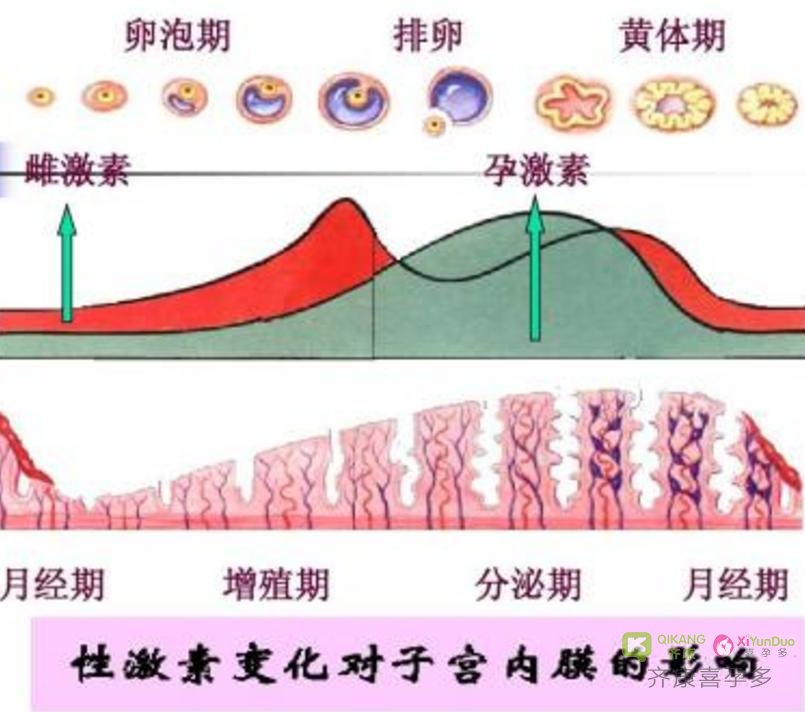 卵巢功能衰退的标志之一 月经量减少 - 喜孕多海外试管医疗