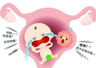 子宫肌瘤是如何影响怀孕的？齐康喜孕多海外试管告诉你