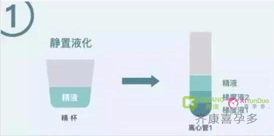 试管婴儿中的洗精术，你了解吗？洗精术到底洗的是什么？