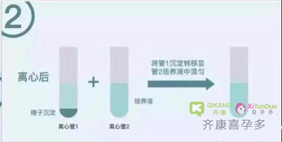 试管婴儿中的洗精术，你了解吗？洗精术到底洗的是什么？