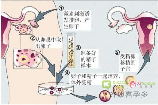 同样是做试管为什么有些人用的费用多，有的人花费的少，差别在哪里？