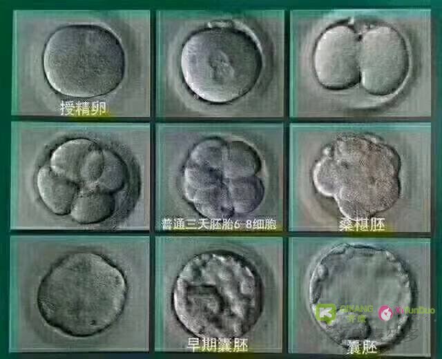 试管婴儿中被称为“上帝之手”的幕后英雄——胚胎师