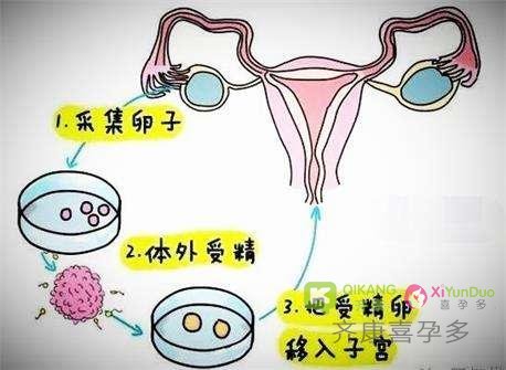 试管婴儿多次促排会对准孕妈带来身体上的伤害吗？