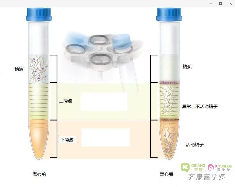 试管婴儿过程中洗精是什么意思？洗精是怎么洗的？ - 喜孕多分享