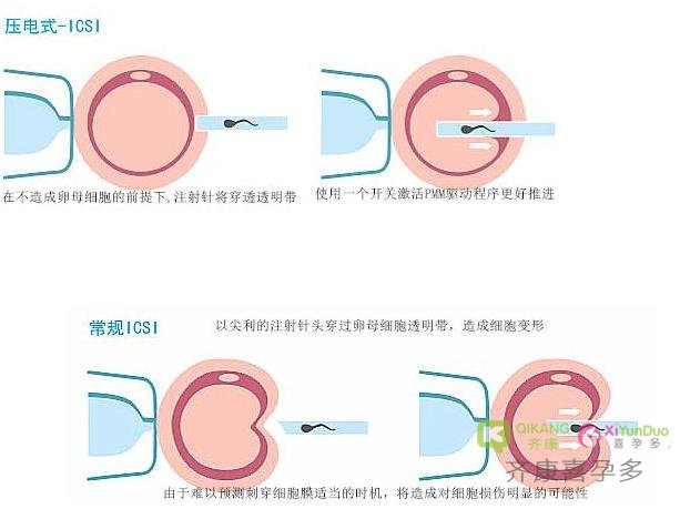 做二代试管婴儿不受精怎么办？卵母细胞激活给你加加油！