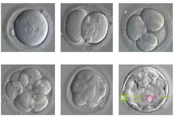 为什么养囊男孩多？关于试管婴儿囊胚养成的误区你踩到几个？
