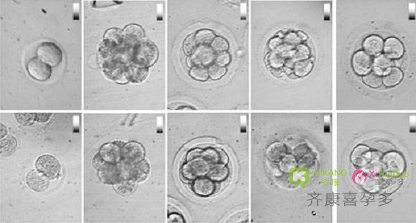 海外试管婴儿知识之什么是优质胚胎？如何挑选优质胚胎？