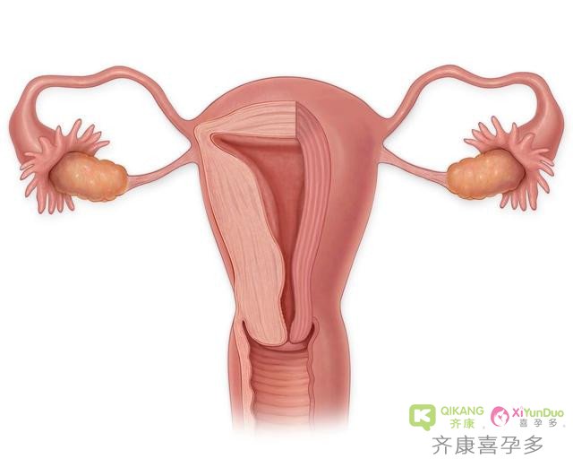 这些坏习惯都是不孕的杀手，但可能每个女性都有 你还舍不得丢弃吗