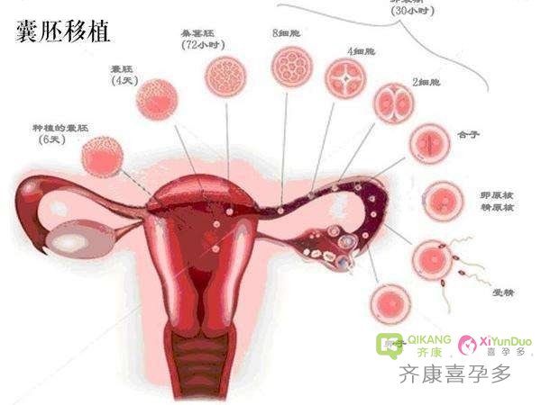 试管婴儿中胚胎冷冻和卵子冷冻，应该如何选择？