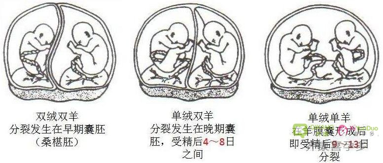【试管移植】放进子宫是一个胚胎  B超怎么看到了两个宝宝？