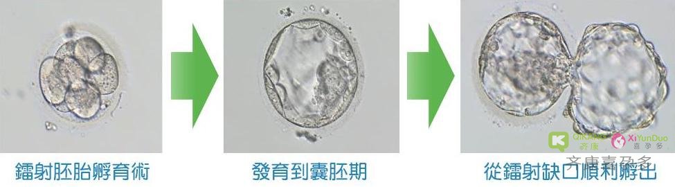 【试管移植】放进子宫是一个胚胎  B超怎么看到了两个宝宝？