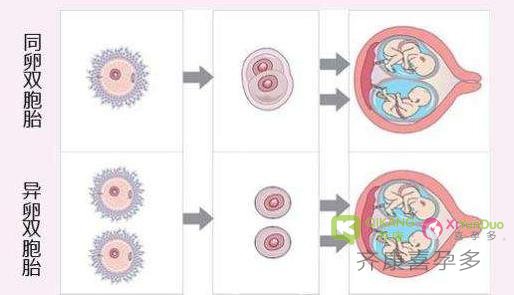 【试管移植】放进子宫是一个胚胎  B超怎么看到了两个宝宝？