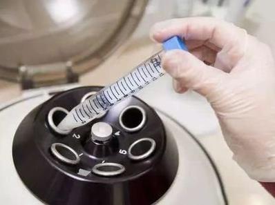 试管婴儿中男方精子碎片率高如何生育健康宝宝