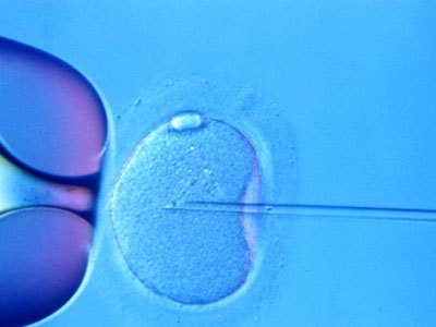 试管移植，是放一个胚胎的成功率高还是两个的高