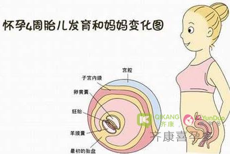 紧急避孕药！ B超辐射！还能继续愉快的怀孕了吗？