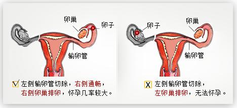 四类病患的家庭要尽早选择试管婴儿怀孕，以免影响生育的最佳时机