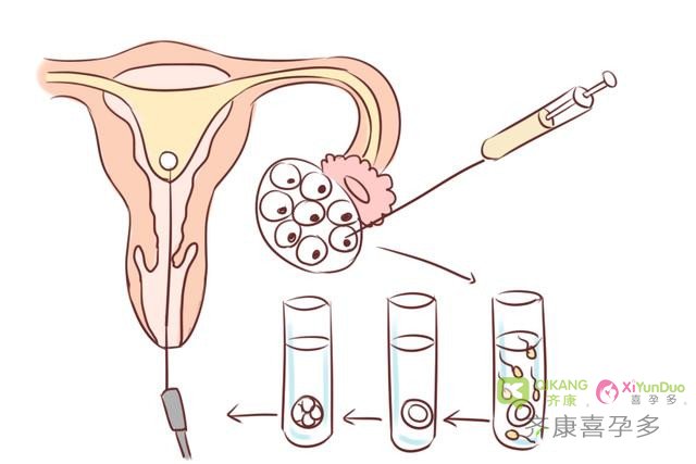 试管婴儿和正常婴儿有什么不一样？齐康喜孕多这样说