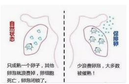 试管婴儿流程中重要的一步——促排卵