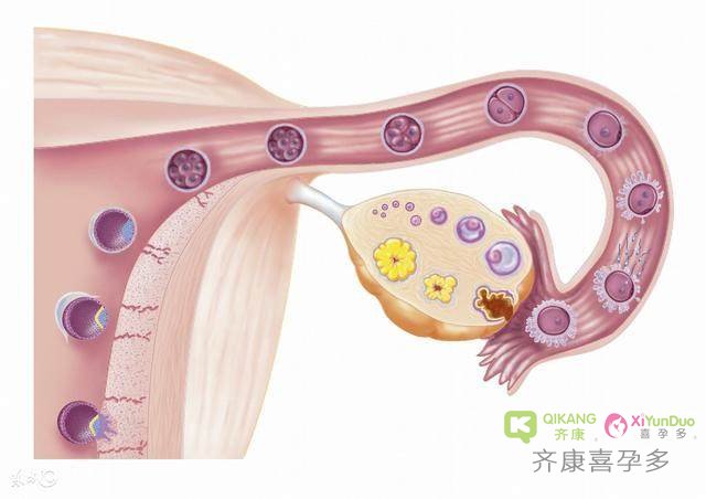 试管婴儿流程中重要的一步——促排卵