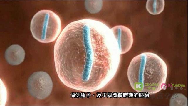 喜孕多海外试管：做试管前男、女方需要做哪些检查？