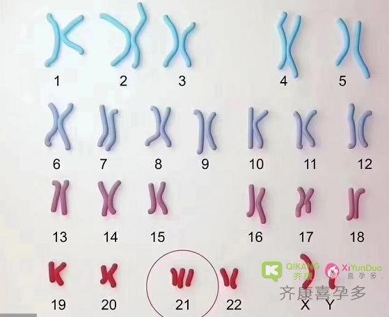 为什么高龄女性囊胚活检会有大部分甚至全部胚胎染色体异常?