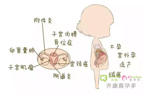 有哪些因素导致现在不孕不育率居高不下？不孕不育的原因有哪些？