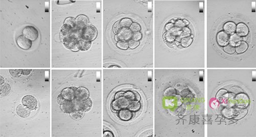 为什么海外生殖中心大都选择移植囊胚？是比鲜胚成功率高吗？