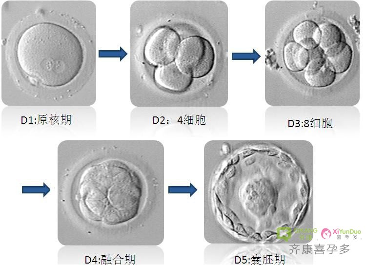 为什么海外生殖中心大都选择移植囊胚？是比鲜胚成功率高吗？