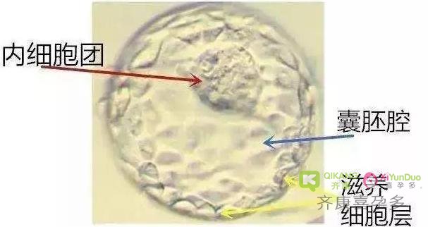 嵌合体胚胎马赛克胚胎是什么意思？可以移植吗？能否着床成功生出健康的宝宝？