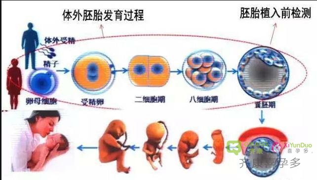 试管婴儿胚胎基因检测ＰＧＤ常见问题有哪些？