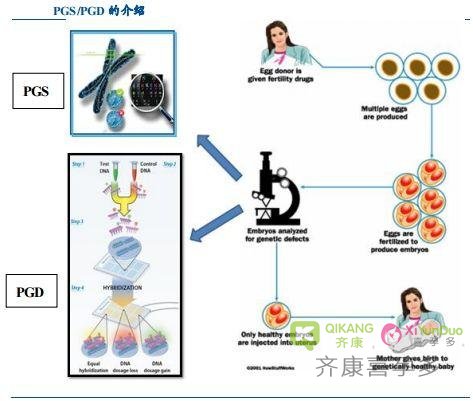 试管婴儿胚胎基因检测ＰＧＤ常见问题有哪些？