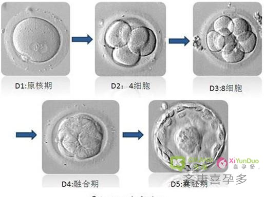 试管婴儿胚胎基因检测ＰＧＤ常见问题有哪些？