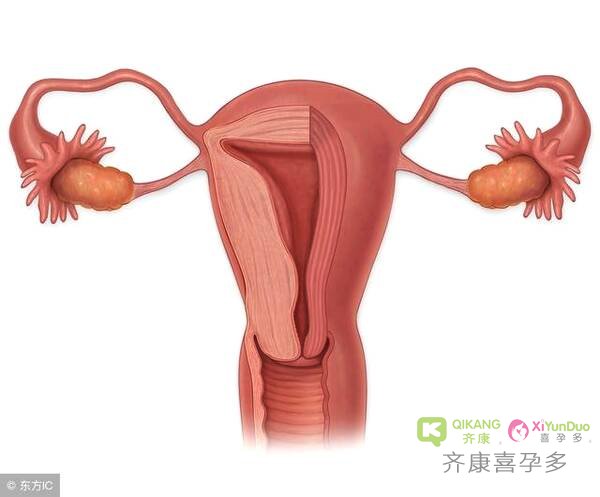 输卵管通而不畅该做手术还是选择试管婴儿辅助生殖？